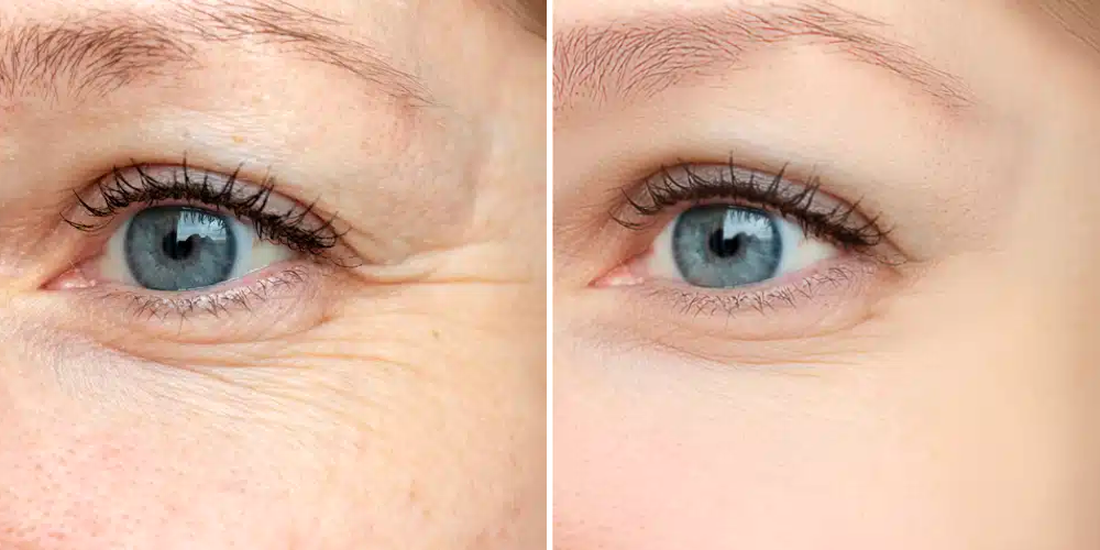 תמונות מטופל